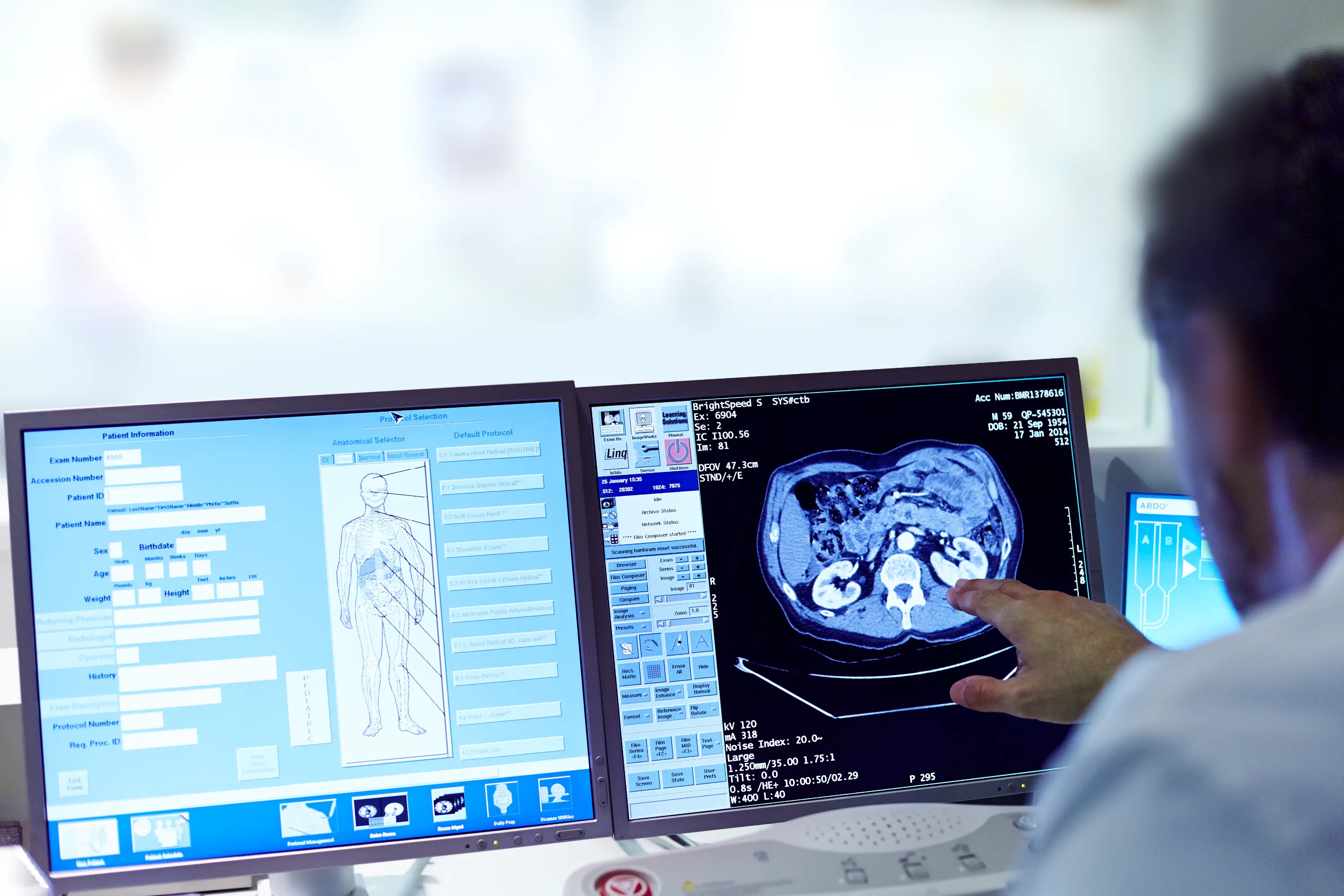 Monitora i tuoi progressi